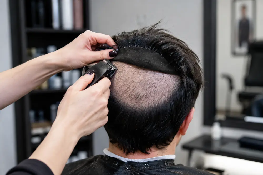 Men's Hair Patches